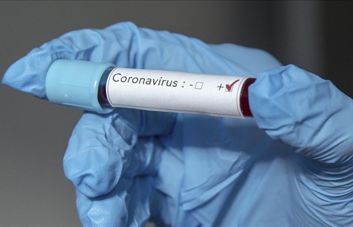 ABD de 5 dakikada sonuç veren quot koronavirüs test kiti
